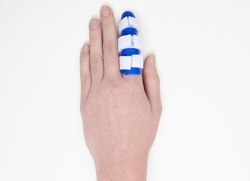 Điều trị trật khớp ngón tay bằng phương pháp nẹp