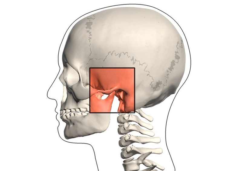 Trật khớp thái dương hàm có nguy hiểm không?3