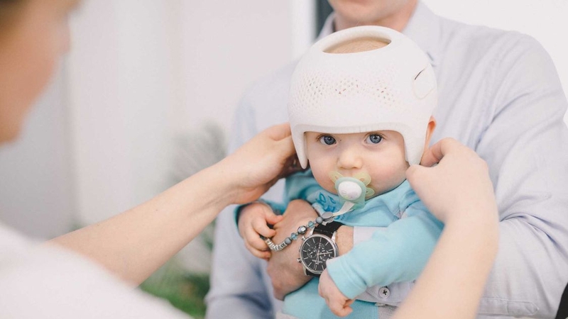 Trẻ 3 tháng bị méo đầu có tròn lại được không? Cần đi khám khi nào? 4