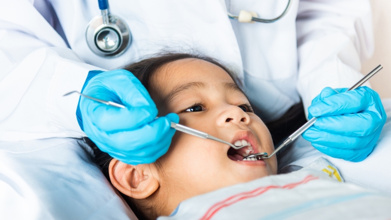 Trẻ 7 tuổi bị sâu răng hàm phải làm sao? 2