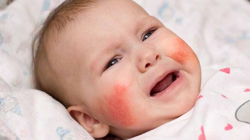 Trẻ 9 tháng hay quấy khóc đêm: Nguyên nhân và cách khắc phục mẹ cần biết 3