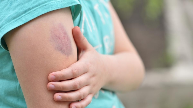 tre-bi-bam-tim-duoi-da-nguyen-nhan-va-huong-dan-xu-ly 1