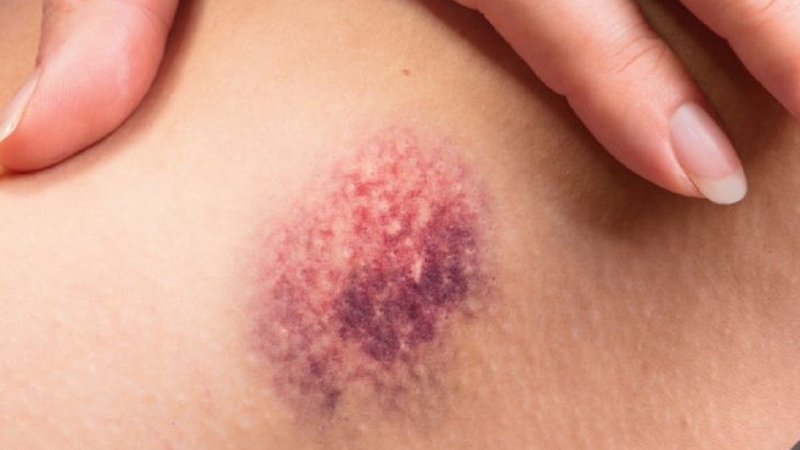 tre-bi-bam-tim-duoi-da-nguyen-nhan-va-huong-dan-xu-ly 2