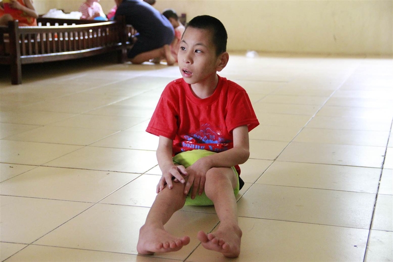 Trẻ bại não cũng thường gặp các khó khăn về nhai, phản xạ thè lưỡi