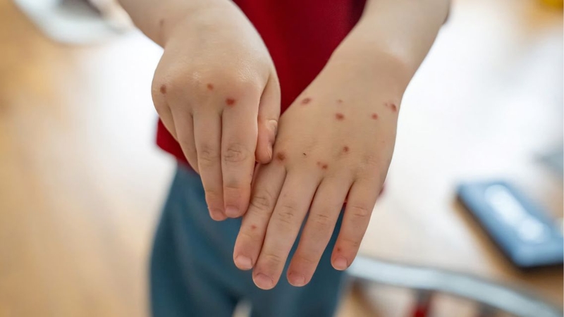 Các loại thuốc bôi không dùng để thay thế điều trị y tế