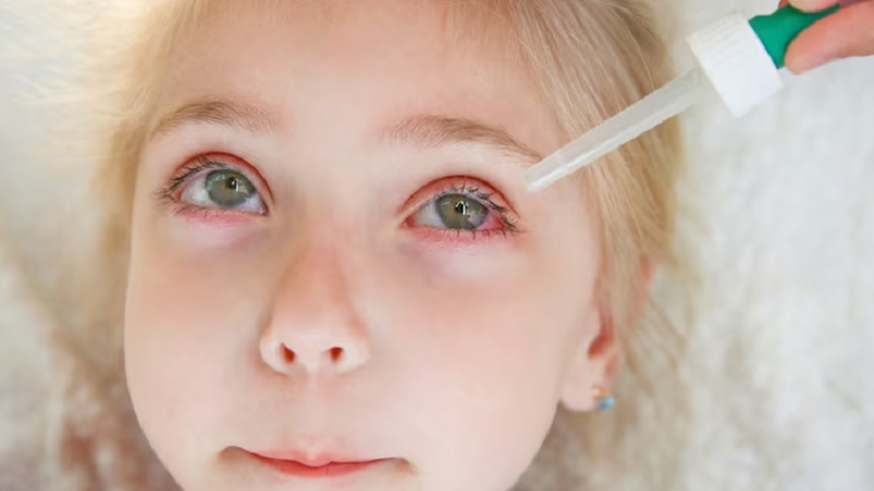 Trẻ bị đau mắt đỏ kèm sốt và những điều bố mẹ cần biết 3