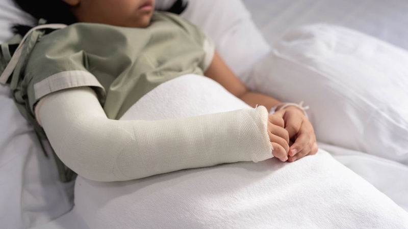 Nhiều phụ huynh muốn biết&nbsp;trẻ bị gãy tay bó bột trong bao lâu​