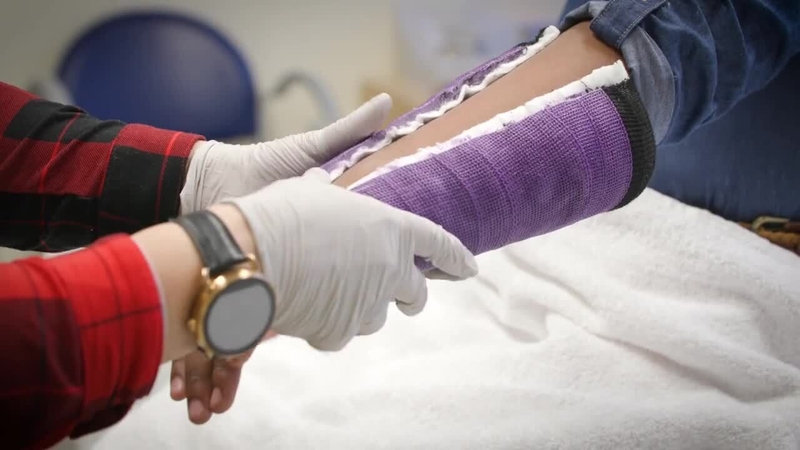 Chăm sóc đúng cách giúp xương bị gãy liền nhanh, sớm được tháo bột