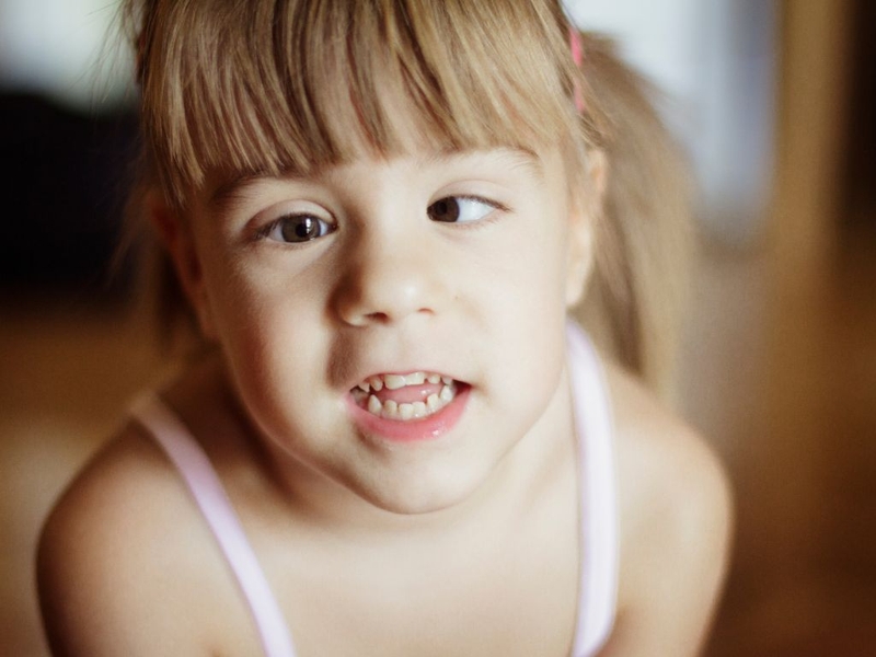 Trẻ bị lác trong​: Nguyên nhân, điều trị và biện pháp phòng ngừa 1