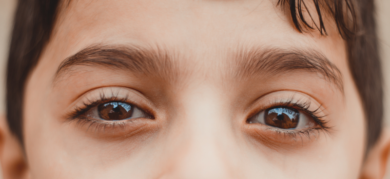 tre-bi-nheo-mat-dau-hieu-bat-thuong-cha-me-can-canh-giac 2.png