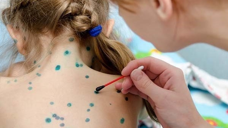 Trẻ bị phỏng dạ: Nguyên nhân, triệu chứng và cách điều trị hiệu quả 3