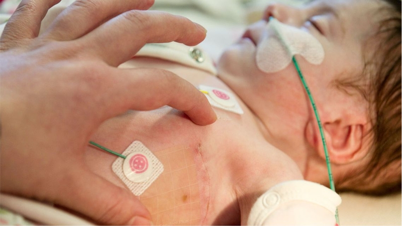 Trẻ bị tim bẩm sinh có tiêm phòng được không 2