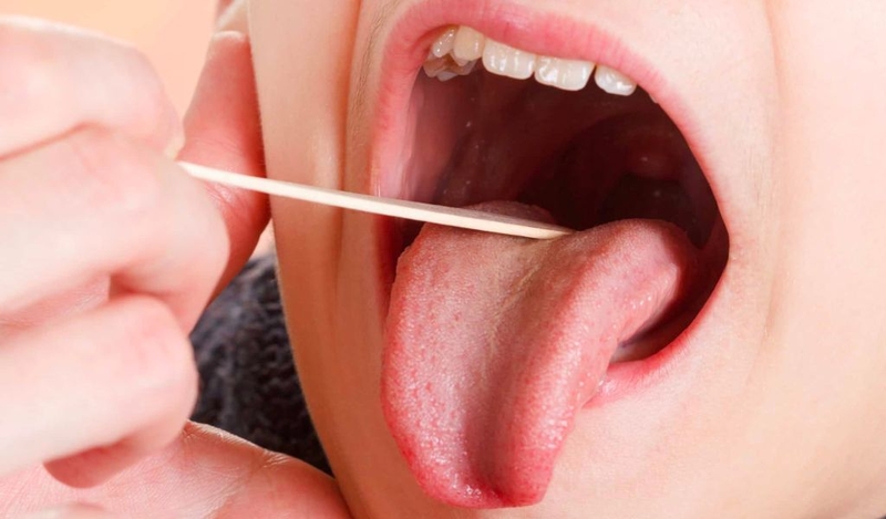 Trẻ bị viêm VA nên uống gì? Chế độ dinh dưỡng và cách điều trị 3