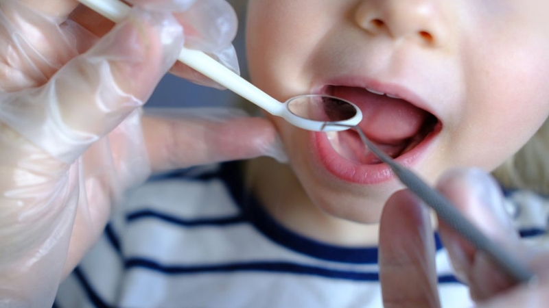 Theo dõi vùng dưới lưỡi để phát hiện sưng, đỏ hoặc chảy máu