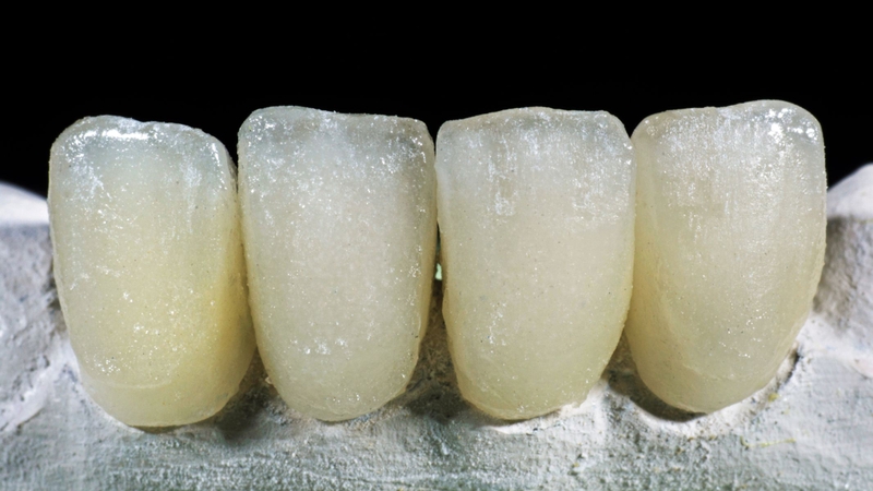 Một số kháng sinh như tetracycline có thể làm răng trẻ bị ố vàng hoặc xỉn màu vĩnh viễn nếu dùng không đúng chỉ định