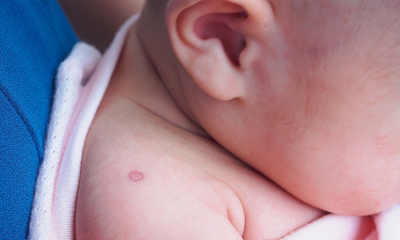 Tất tần tật về tiêm phòng lao cho trẻ 3