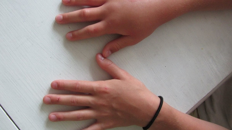 Trẻ em bị đau khớp ngón tay cảnh báo bệnh gì? Cách xử lý khi trẻ bị đau khớp ngón tay? 1