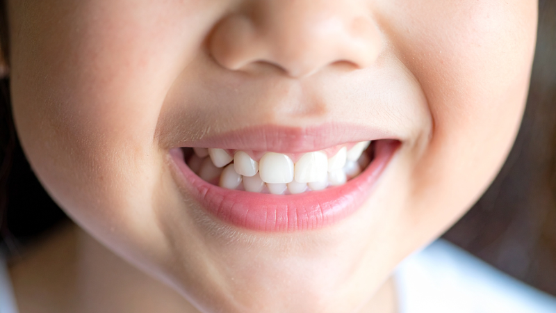 Quá trình mọc răng ở mỗi bé có thể khác nhau