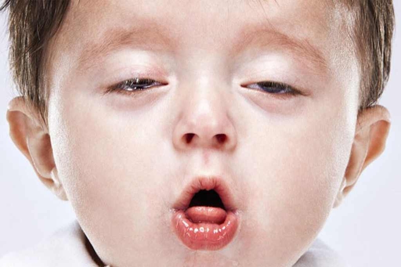 Trẻ ho kéo dài không sốt là triệu chứng của bệnh gì? Có nguy hiểm không? 1