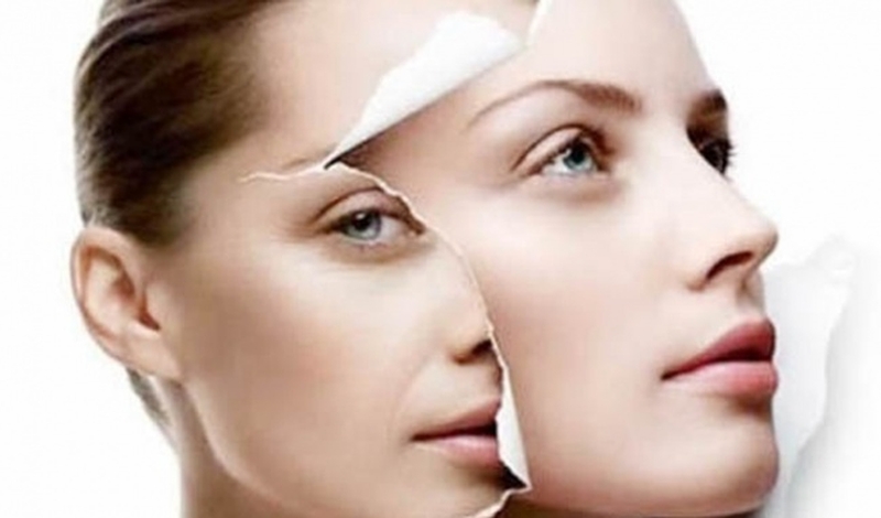 Trẻ hóa da là gì? Những cách trẻ hóa da cho nữ giới 2