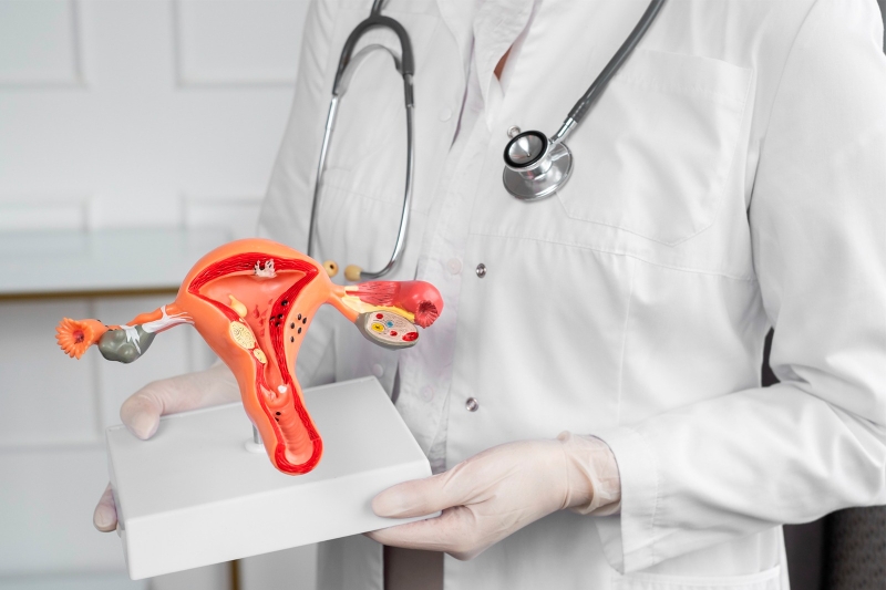 Chậm kinh trên 1 tháng khả năng cao liên quan đến bệnh phụ khoa và vấn đề sức khỏe sinh sản