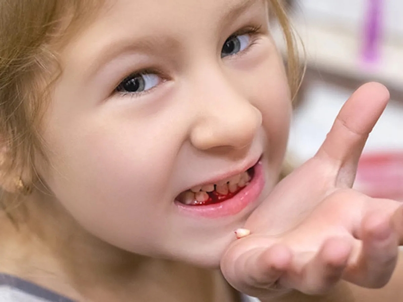 tre-moc-va-thay-rang-sua-khi-nao-mot-so-dieu-can-biet-khi-cham-soc-rang-sua 1.jpg