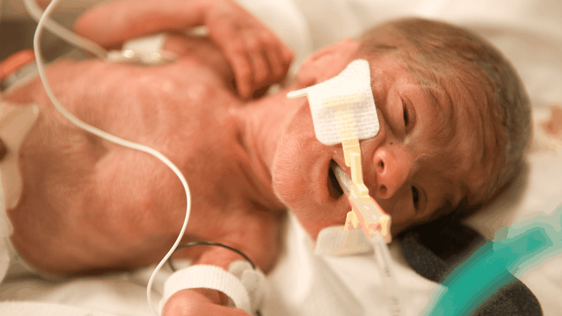 Trẻ sinh non 26 tuần có nuôi được không? 2