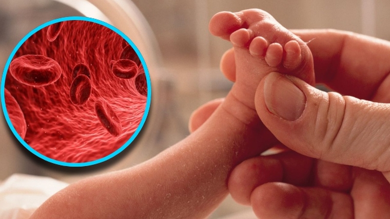 Trẻ sinh non bị thiếu máu: Nguyên nhân, dấu hiệu và cách điều trị hiệu quả 1