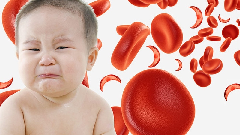 Trẻ sinh non bị thiếu máu: Nguyên nhân, dấu hiệu và cách điều trị hiệu quả 2