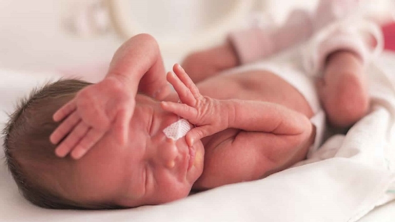 Trẻ sinh non ở tuần 28 và những điều cần biết 2