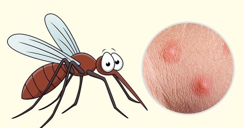 Trẻ sơ sinh bị muỗi đốt mưng mủ có nguy hiểm không 2