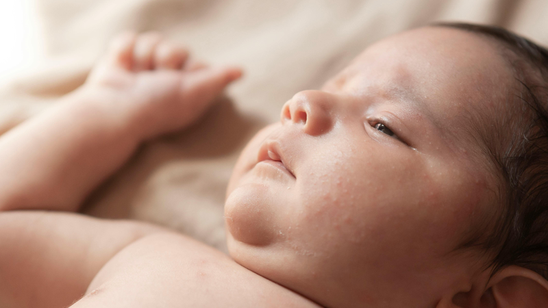 Cách nhận biết dấu hiệu trẻ sơ sinh bị nổi mụn đầu trắng