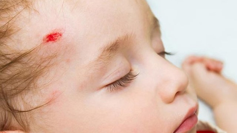 Trẻ sơ sinh bị té võng: Nguyên nhân, hậu quả và cách phòng tránh 1