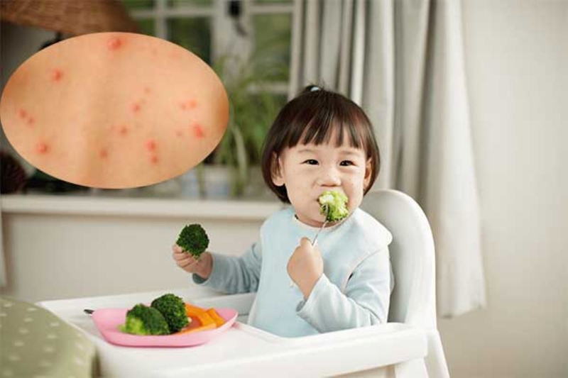 Cung cấp một chế độ dinh dưỡng hợp lý để bé nhanh khỏi bệnh thủy đậu