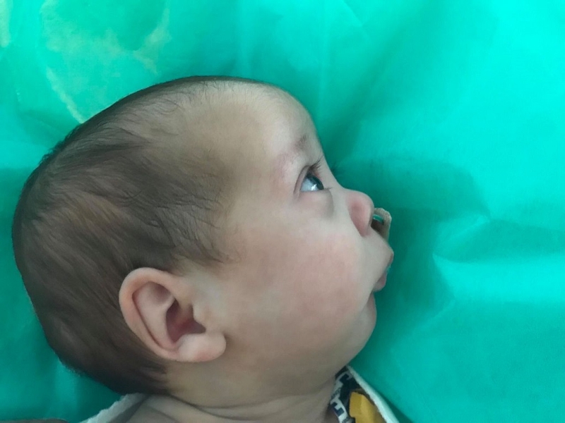 Trẻ sơ sinh hay lè lưỡi có sao không? Trẻ có bị down không? 3