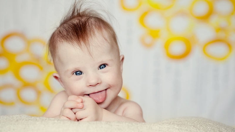 Trẻ sơ sinh hay lè lưỡi có sao không? Trẻ có bị down không? 4