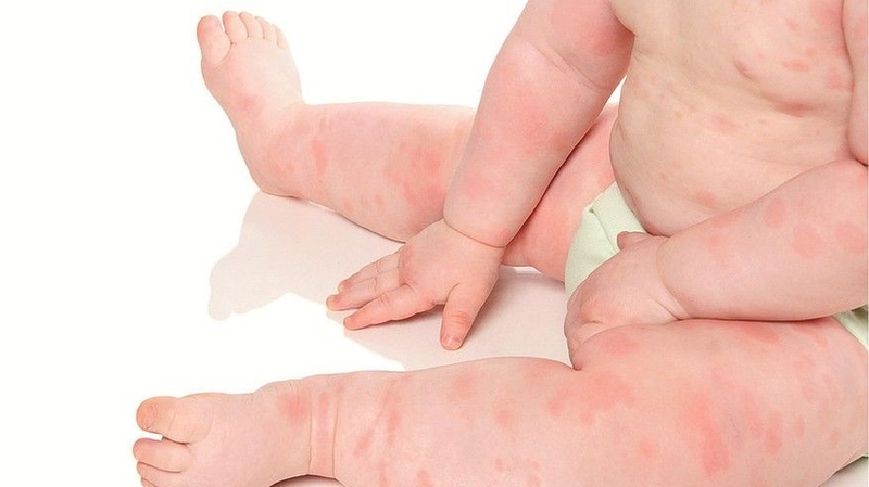 Trẻ sơ sinh tiêm kháng sinh nhiều có sao không? Ba mẹ cần lưu ý 2