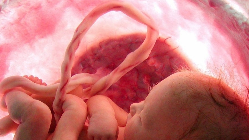 Trẻ sơ sinh uống nước ối có sao không? 2