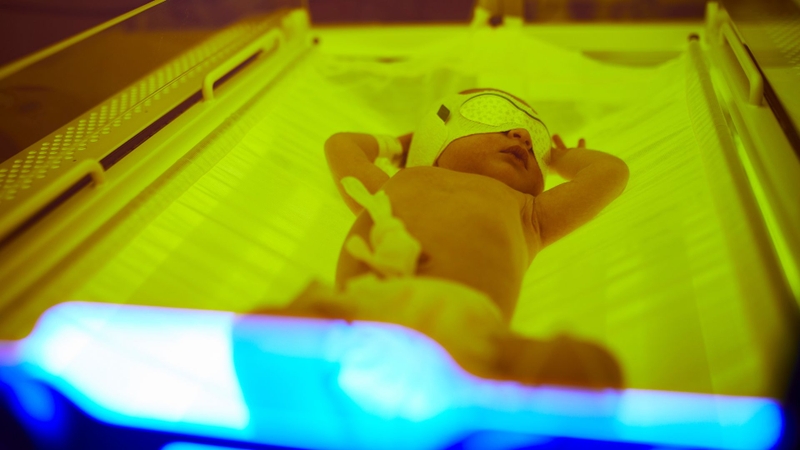 Chiếu đèn là phương pháp phổ biến và an toàn cho trẻ bị vàng da