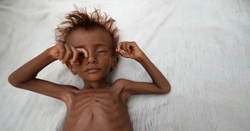 Trẻ suy dinh dưỡng uống sữa gì 01