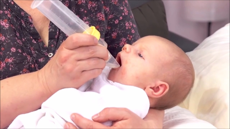 Trẻ thường bị hở hàm ếch ở những vị trí nào? 2