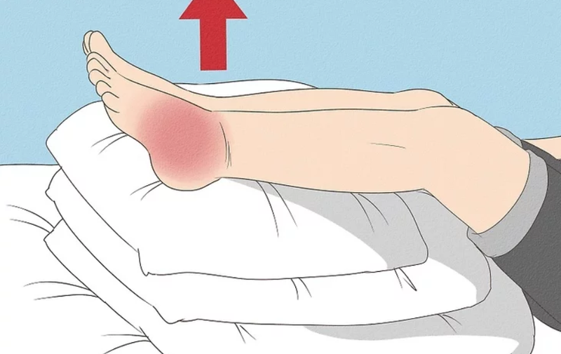 trẹo chân bao lâu thì khỏi 2.jpg