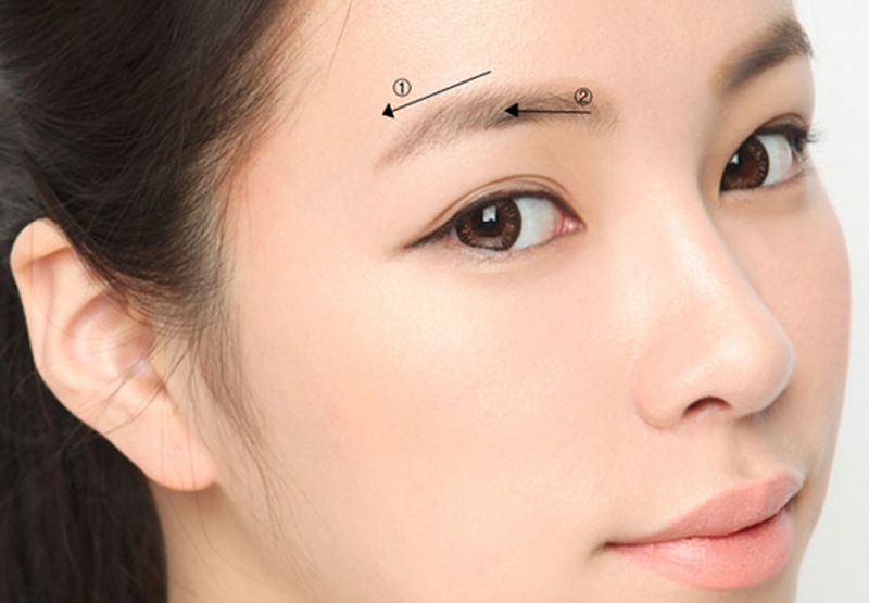 Khi những sợi chỉ nâng biến mất, vùng da quanh chân mày vẫn căng và tồn tại trong khoảng 3-5 năm