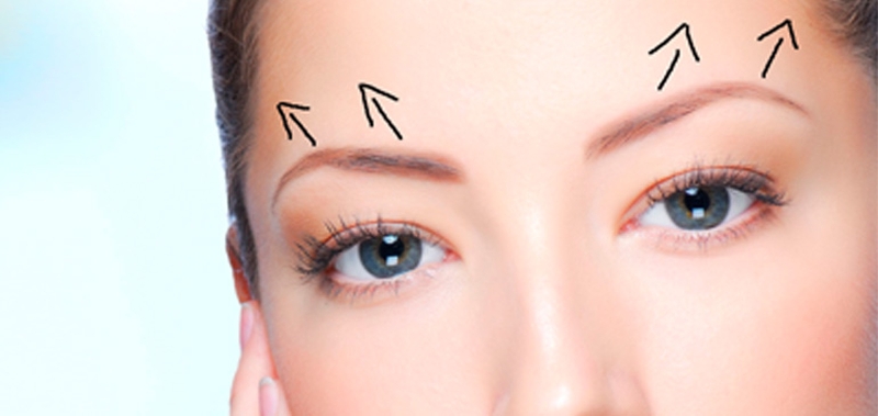 Treo chân mày có những ưu điểm quan trọng giúp khắc phục nhược điểm của khóe mắt