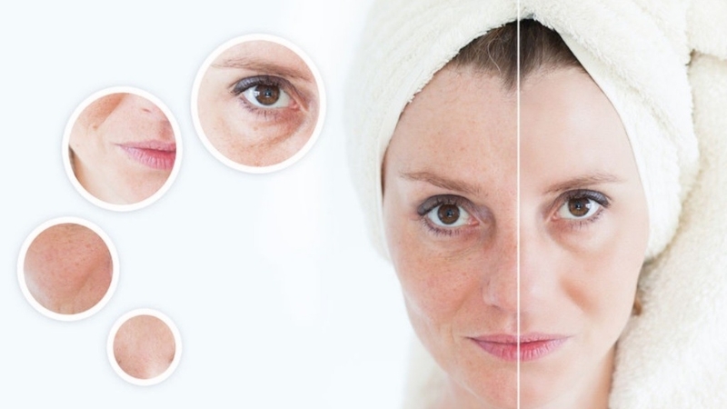 Tretinoin - Cứu tinh cho làn da phái đẹp - Hình 6