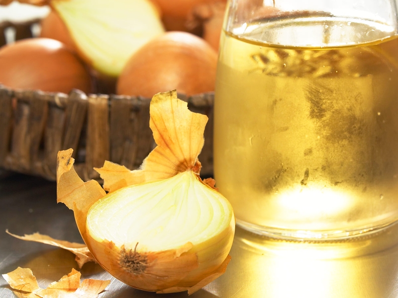 Trị đồi mồi bằng hành tây hiệu quả tại nhà3