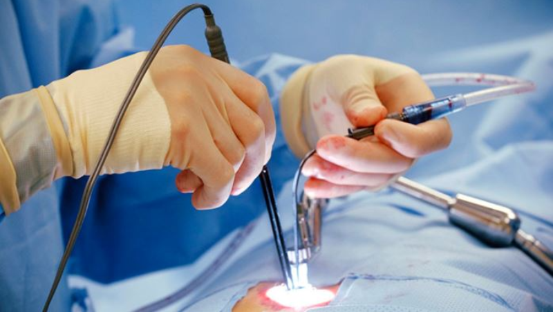 Trĩ là gì? Khi nào nên cắt trĩ bằng phương pháp HCPT? 3