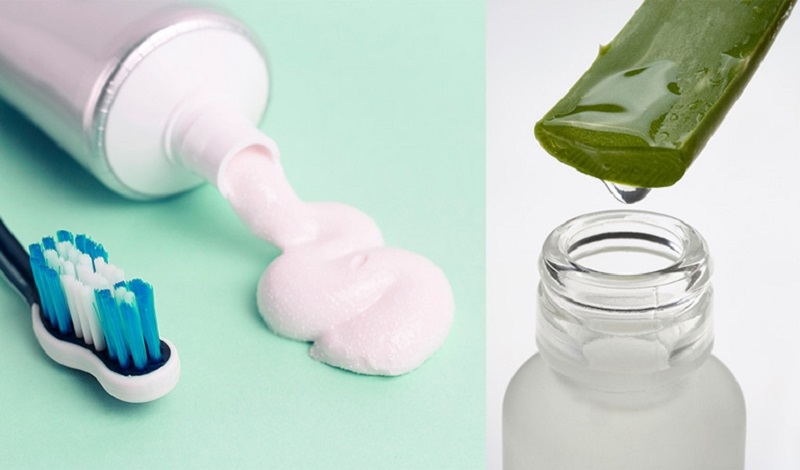 Trị mụn ẩn bằng kem đánh răng và nha đam