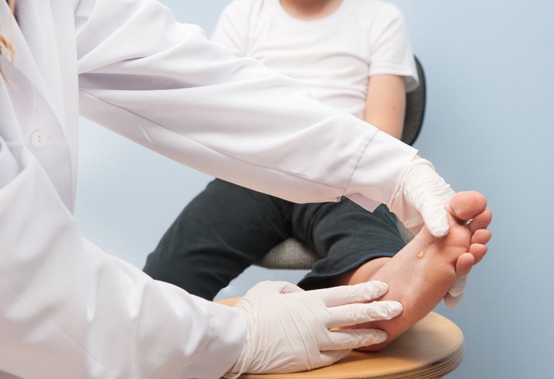 Trị mụn cóc bằng chanh tại nhà khiến da đẹp chỉ sau 1 tuần 1