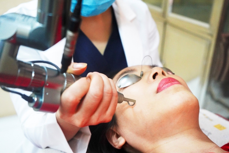 Trị nám bằng laser bao nhiêu tiền? Có hiệu quả không 1